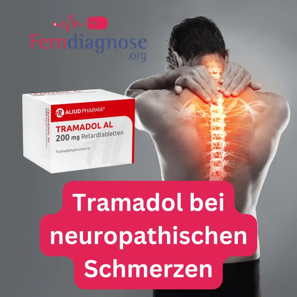 Tramadol bei neuropathischen Schmerzen